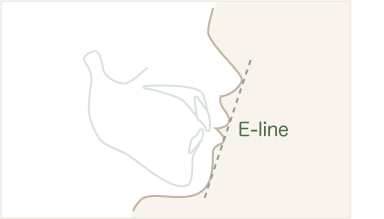 E-lineと口唇の関係