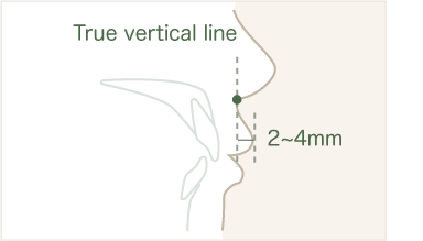 True vertical lineと上唇の関係