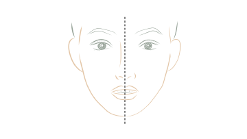 顔面正中線と前歯正中線の一致