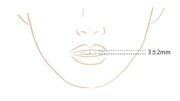 リラックスした状態での上顎の前歯の露出量3±2mm