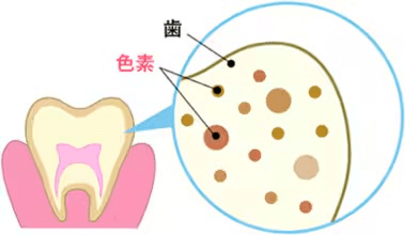 歯に色素が付着している状態