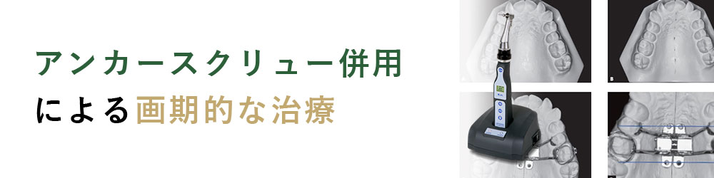 アンカースクリュー矯正特集