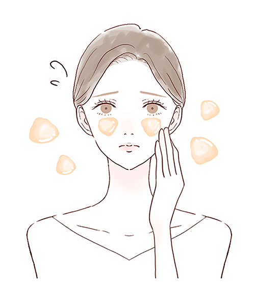 オイリー肌