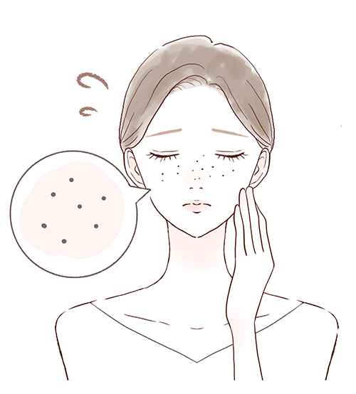 毛穴のくろずみ