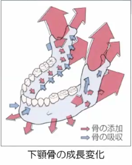 子どもの矯正治療の基礎知識①｜赤坂矯正歯科｜港区赤坂駅すぐの矯正専門歯科クリニック