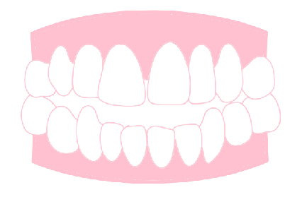 前歯で噛めない