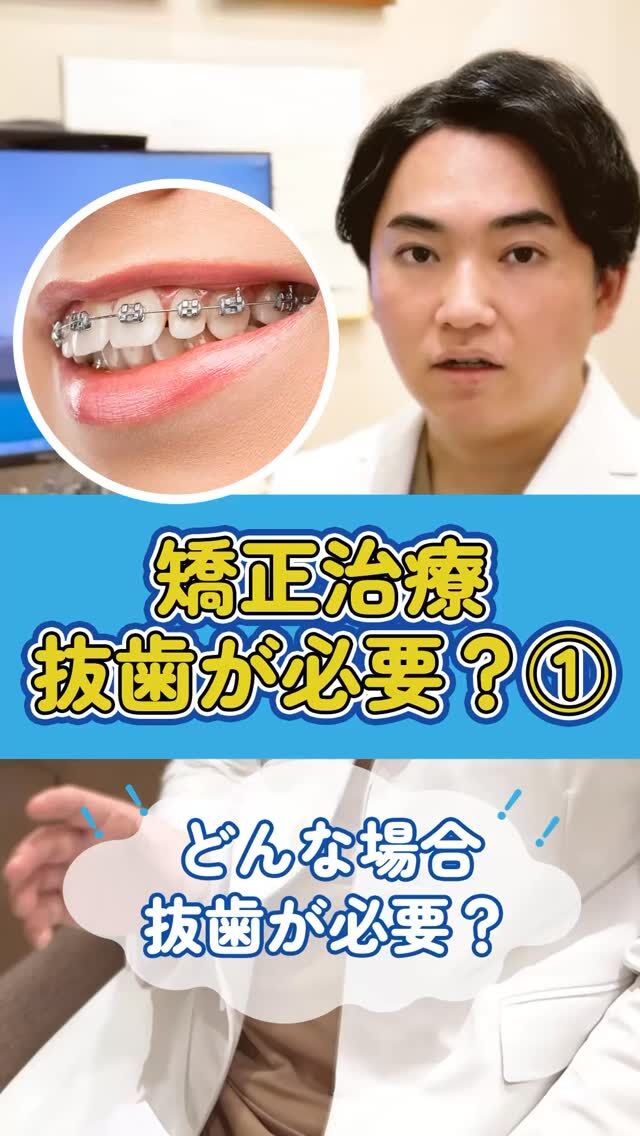 🦷非抜歯矯正のリスクについて

✔ 日本人は「顎が小さく、歯が大きい」ため、抜歯が必要なケースが多い 
✔ 抜歯は健康面に影響はなく、安全に行われる処置です 
✔ 非抜歯で無理に歯を並べると、口元が前に出たり、後戻りリスクも
✔ 抜歯の有無は「骨格」や「Eライン」「口元のバランス」でも判断されるべき 
✔ 大切なのは、丁寧に説明してくれる歯科矯正のプロに相談すること

📌後で見返したい方は、今のうちに【保存】を忘れずに！

▶ @akasaka_kyousei プロフィールのリンクから、無料カウンセリング予約受付中
▶ DMで「抜歯について相談したい」と送ってもOK！

▶︎赤坂矯正歯科
0362309959
東京都港区赤坂6-3-16-1Ｆ
平日11:00〜19:30/土日10:00〜18:00

#日本矯正歯科学会認定医 

#マウスピース矯正 #矯正迷ってる #ワイヤー矯正 #裏側矯正 #矯正専門医 #港区矯正 #歯科矯正 #赤坂矯正歯科