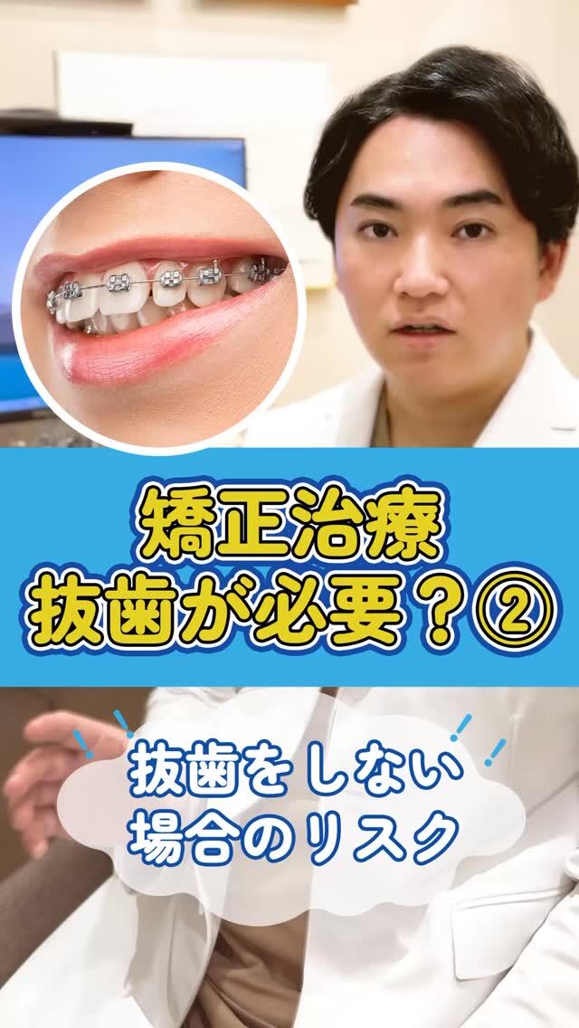 🦷歯を抜かない矯正治療のリスクと真実を徹底解説！

　「抜かない矯正＝安全」と思っていませんか？実は歯を抜かないことで、治療難易度が上がる、口ゴボが治らない、後戻りしやすくなるケースもあります。
この動画では、非抜歯矯正のリスクと真実をわかりやすく解説します。

📌後で見返したい方は、今のうちに【保存】を忘れずに！

▶ @akasaka_kyousei プロフィールのリンクから、無料カウンセリング予約受付中
▶ DMで「抜歯について相談したい」と送ってもOK！

▶︎赤坂矯正歯科
0362309959
東京都港区赤坂6-3-16-1Ｆ
平日11:00〜19:30/土日10:00〜18:00

#マウスピース矯正 #矯正迷ってる #ワイヤー矯正 #裏側矯正 #矯正専門医 #港区矯正 #歯科矯正 #赤坂矯正歯科