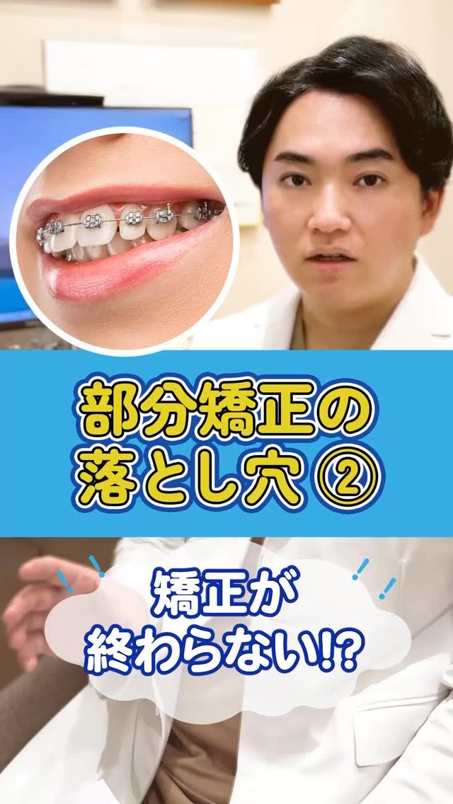 前歯だけ治せばOK？実はそれ…失敗するかも【赤坂矯正歯科】

前歯だけを治す部分矯正は、手軽で人気があります。
でも実は、全体のバランスを見ないと失敗することもあるんです。

なかには、「とりあえず前歯だけ」と歯医者ですすめられて、
治療がうまく終わらなかった…という相談も。

この動画では、
・なぜ部分矯正だけだと後悔することがあるのか？
・“本当に患者さんのことを考えた治療”とは？
を、歯科矯正医がやさしく正直にお話しします🦷

📌後で見返したい方は、今のうちに【保存】を忘れずに！

▶ @akasaka_kyousei プロフィールのリンクから、無料カウンセリング予約受付中
▶ DMで「抜歯について相談したい」と送ってもOK！

▶︎赤坂矯正歯科
0362309959
東京都港区赤坂6-3-16-1Ｆ
平日11:00〜19:30/土日10:00〜18:00

#マウスピース矯正 #矯正迷ってる #ワイヤー矯正 #裏側矯正 #矯正専門医 #港区矯正 #歯科矯正 #赤坂矯正歯科