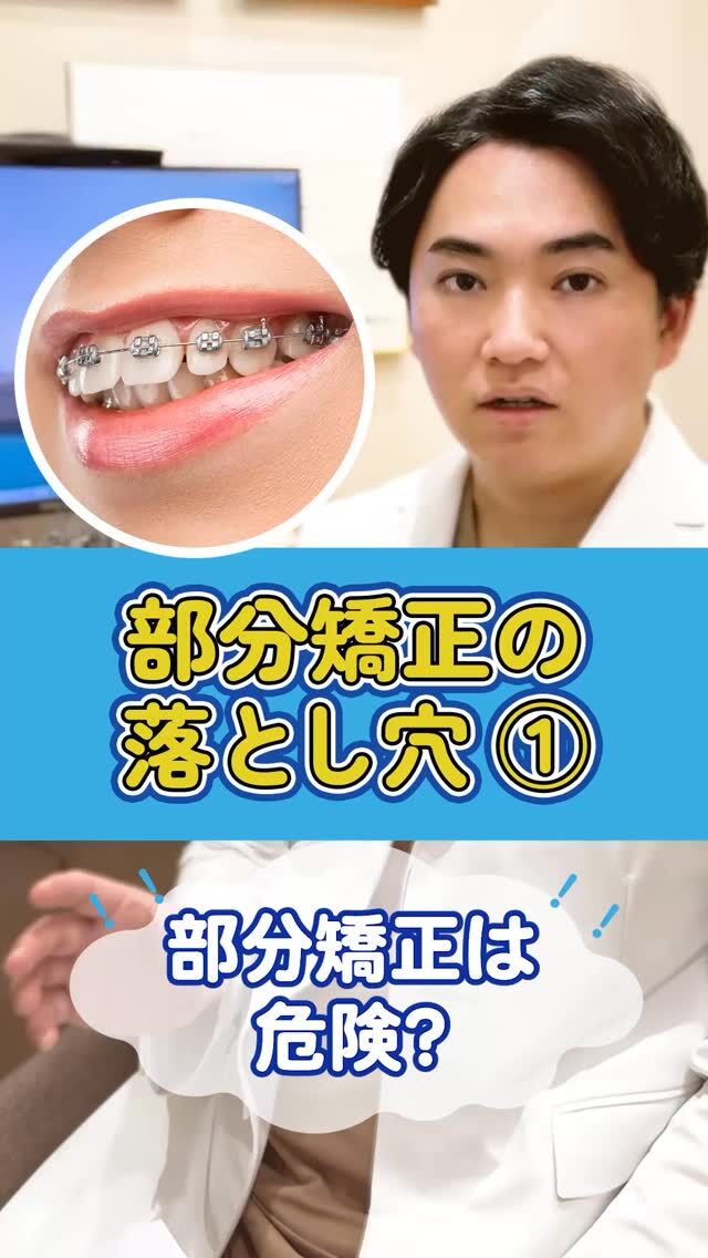 「前歯だけ部分矯正したい」…ちょっと待って！

最近、前歯だけの部分矯正を希望される方がとても増えています。
でも実は、多くの方が奥歯からズレていることをご存知ですか？

原因から治さないと、せっかく整えた歯並びも1〜2年で後戻りしてしまうことも…💦
この動画では、「なぜ部分矯正だけでは不十分なことがあるのか？」を、
歯科矯正医がわかりやすくお伝えします🦷✨

📌後で見返したい方は、今のうちに【保存】を忘れずに！

▶ @akasaka_kyousei プロフィールのリンクから、無料カウンセリング予約受付中
▶ DMで「抜歯について相談したい」と送ってもOK！

▶︎赤坂矯正歯科
0362309959
東京都港区赤坂6-3-16-1Ｆ
平日11:00〜19:30/土日10:00〜18:00

#マウスピース矯正 #矯正迷ってる #ワイヤー矯正 #裏側矯正 #矯正専門医 #港区矯正 #歯科矯正 #赤坂矯正歯科